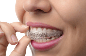 Close up of a woman applying her Invisalign.