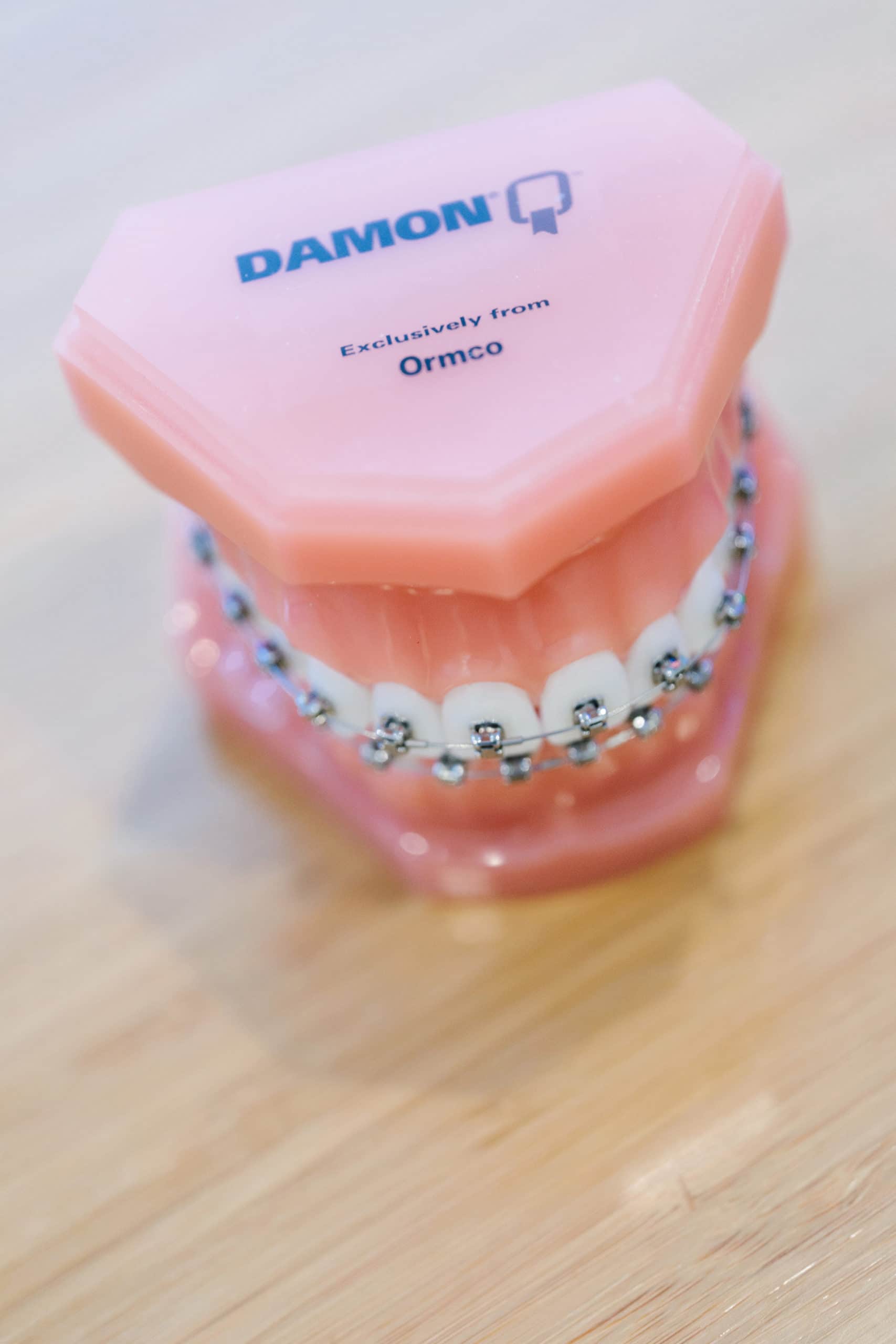 A model of teeth with Damon Braces.