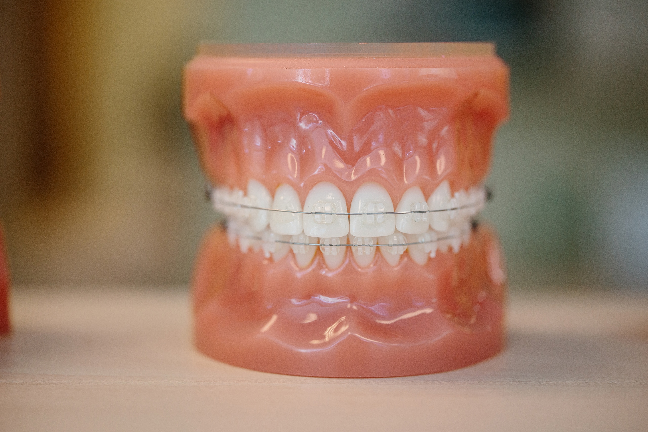 A plastic model of teeth with Damon Clear braces.