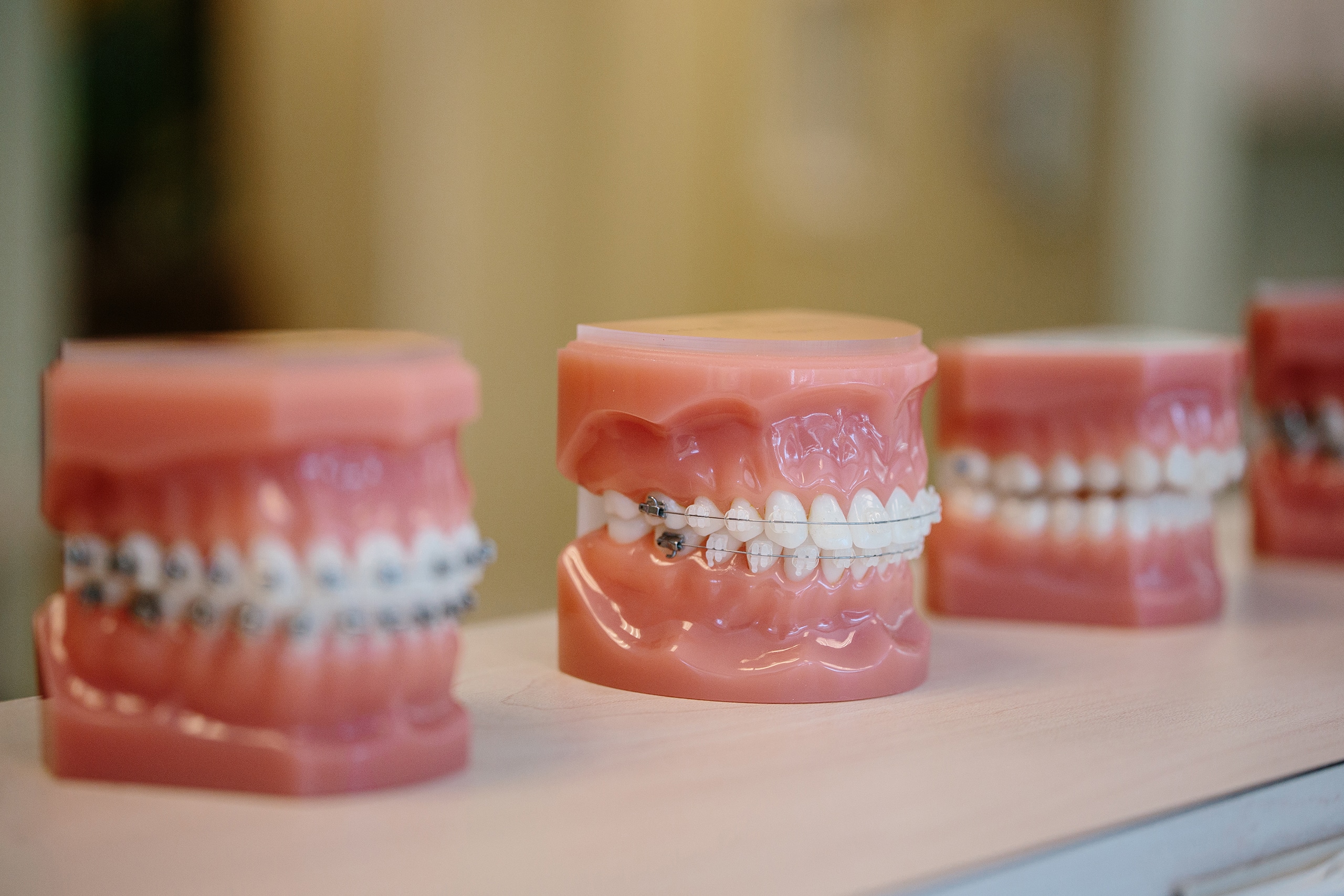A set of plastic teeth models with metal and clear braces.