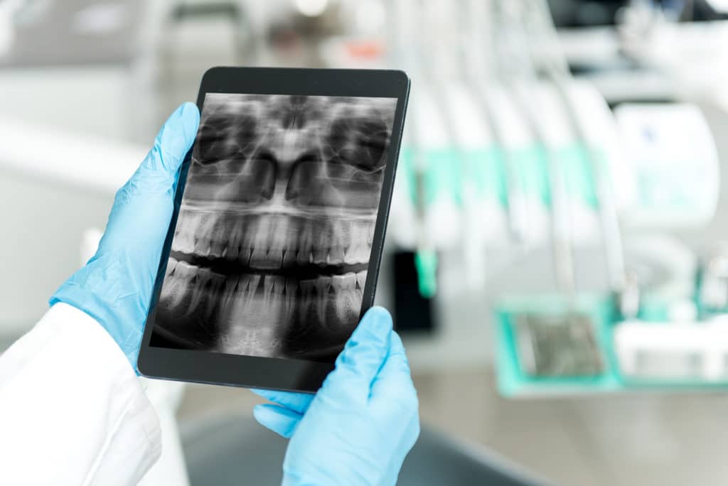 an orthodontist reviewing a patient's x rays on an ipad