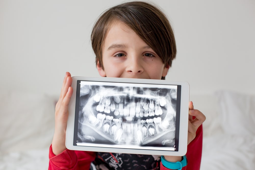 a little boy holding an ipad with dental x rays in front of his face