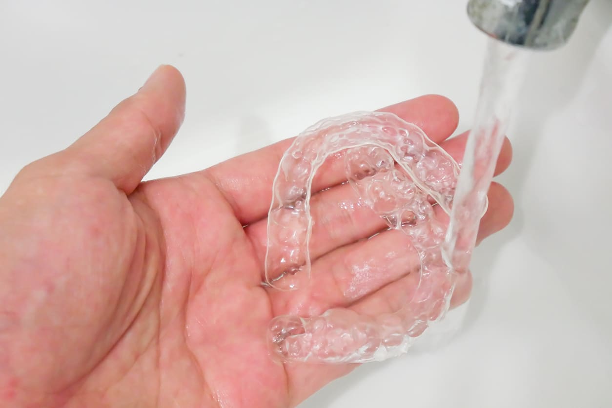 spark aligners are rinsed under a sink tap