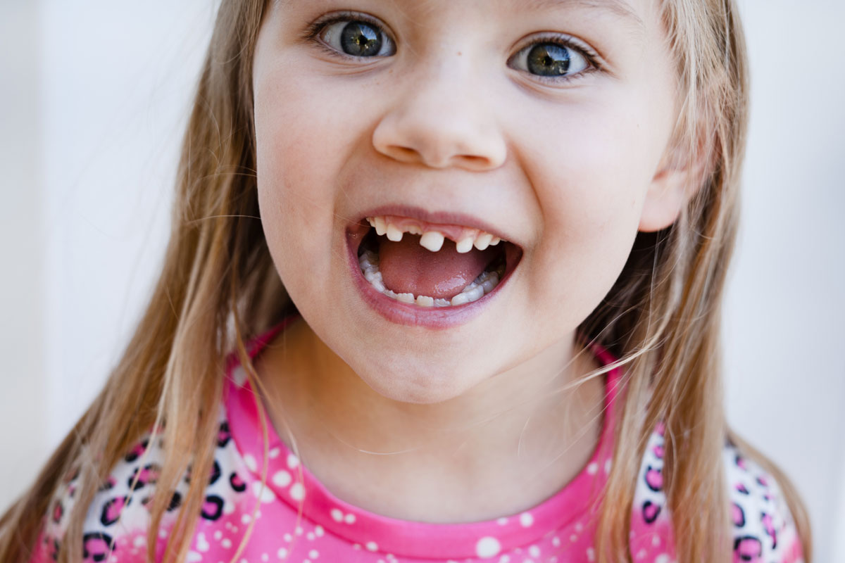 a little girl smiles wide revealing missing baby teeth